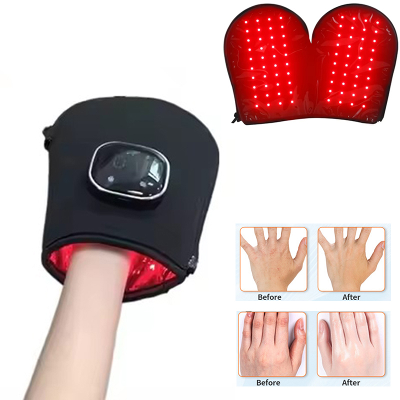 Heated Gloves Electric - NUEVO Dispositivo de Terapia de Luz